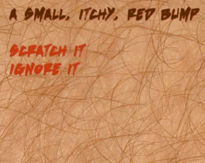 Itch